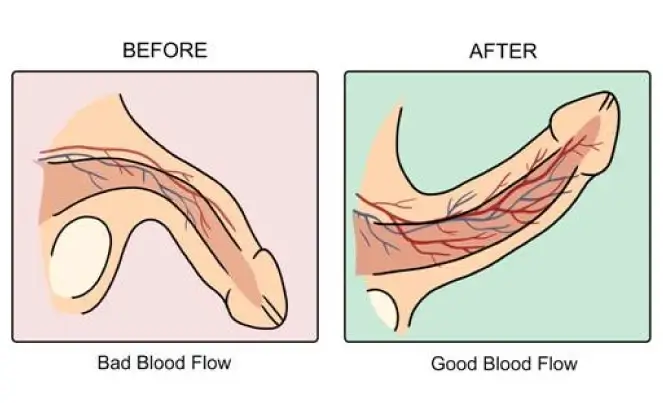 วิธีทําให้น้องชายใหญ่ pantip